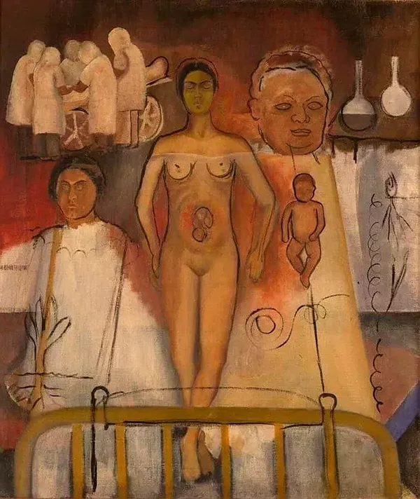 Frida e Operação Cesariana (1932) - Pintura de Frida Kahlo
